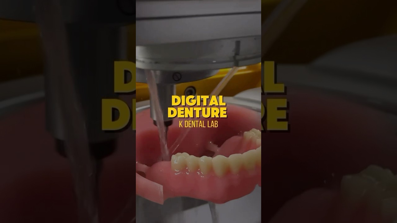 Digital Denture: an innovative solution for precise and perfect dentures