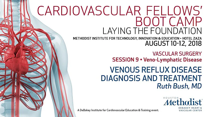 Venous Reflux Disease Diagnosis and Treatment (Rut...
