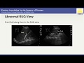 EAST Master Class Webinar Ultrasound In Trauma And ICU Care 