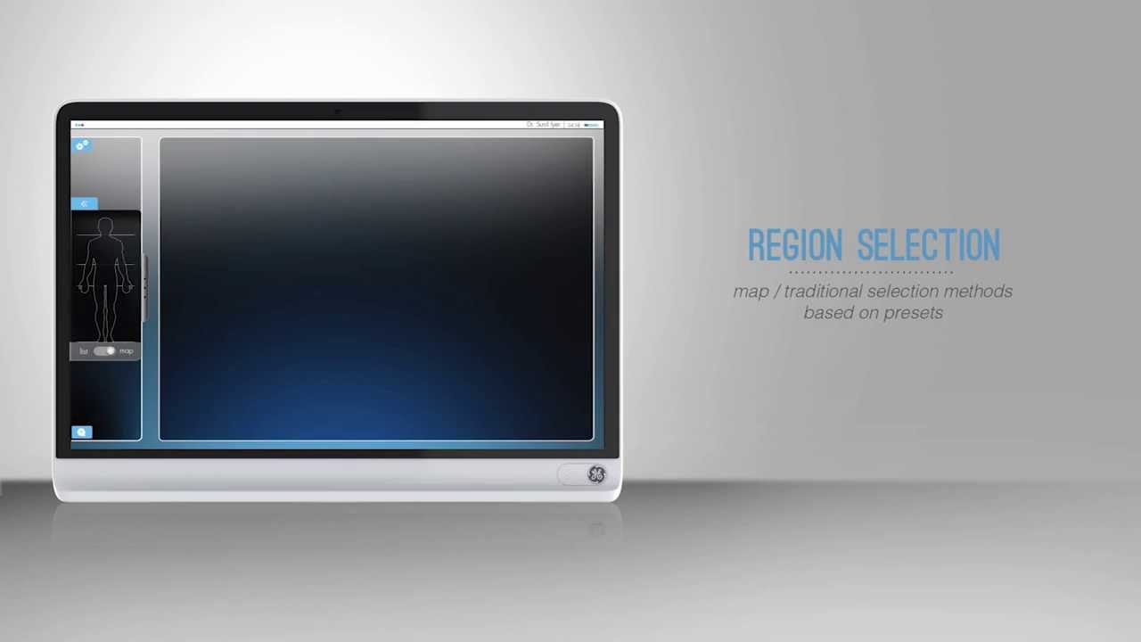 GE Ultrasound - Elixir User Scenario & Interface - YouTube