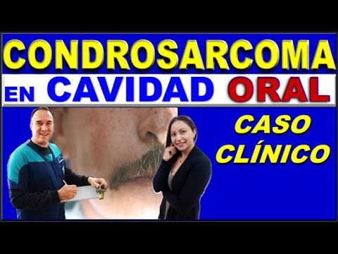 Vídeo: Càncer De Nas (condrosarcoma) En Gossos