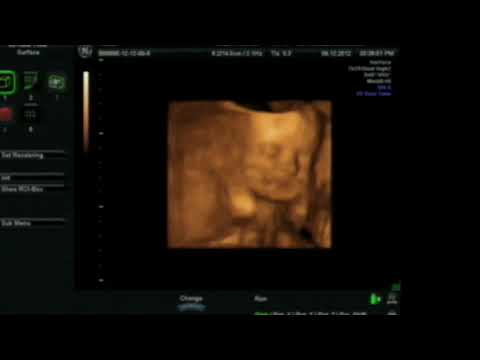 4d ultrasound pictures at 27 weeks 4d ultrasound pictures at 27 weeks