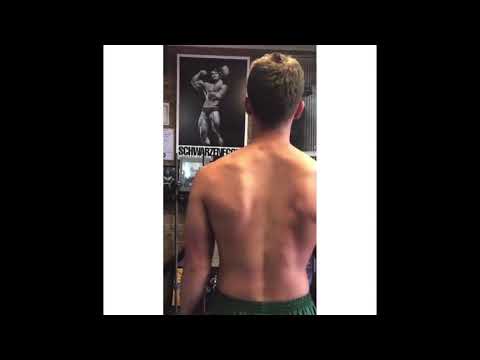 Exercises to fix a winged scapula.