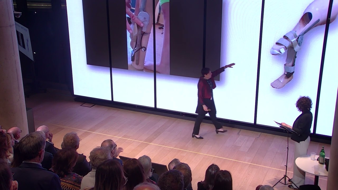 Lo Smart Knee e la ricerca di ALYN