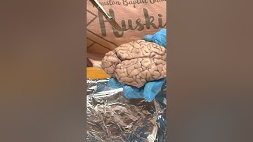 Sheep brain dissection- part 2
