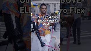 Praveen has been sharing his journey finding the right prosthesis. Read his full story! #blog #tech
