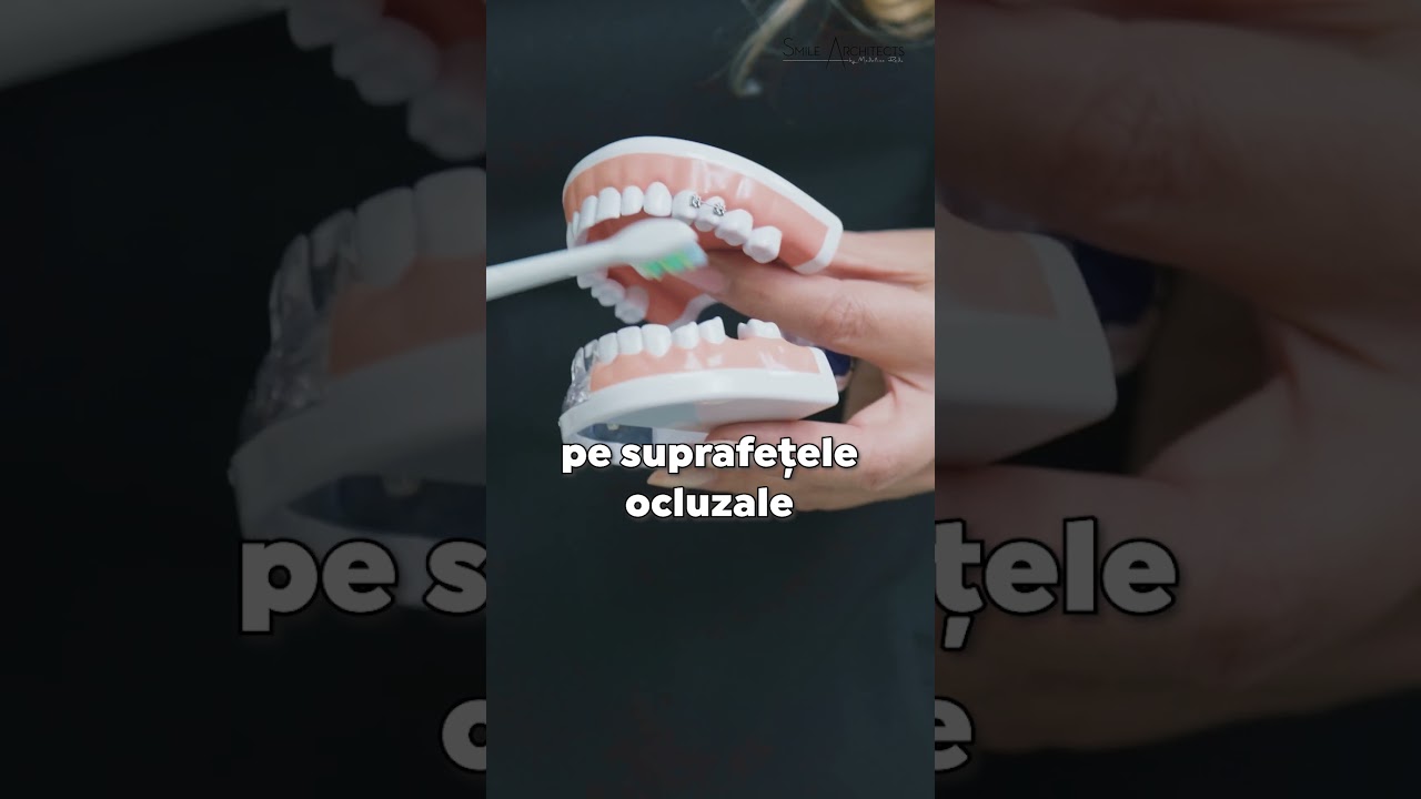Periajul dentar-Cum ne spalam corect pe dinti