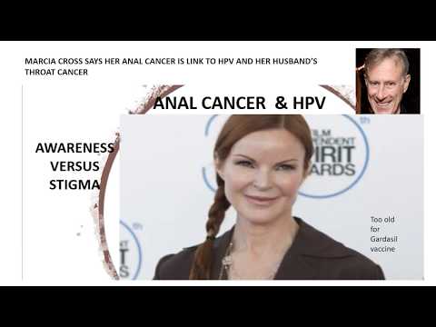 Video: Marcia Cross Leerde Haar Anale Kanker Die Waarschijnlijk Wordt Veroorzaakt Door Dezelfde HPV-stam Als De Keelkanker Van De Echtgenoot