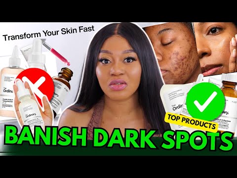 Dark Spot Solutions from The Ordinary | My Top Picks That Work