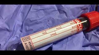 Lucy Letby Miscarriage of Justice - Lab Elevated Insulin Readings by 788% in New Revelation