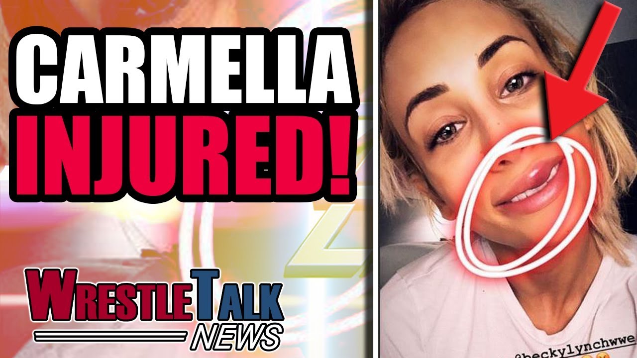 Carmella leak wwe WWE Deletes