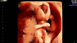 IMG 20130206 2 5 VolCine