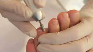 Fodterapeut 2770 Kastrup Amagergruppens Fodterapeuter