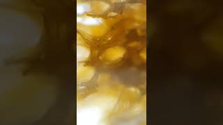 ##microscope #microscopic #×40 #Microbiology #kitchen #sponge