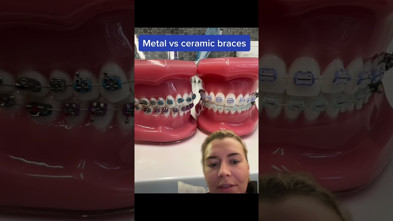 These are very generic differences! 