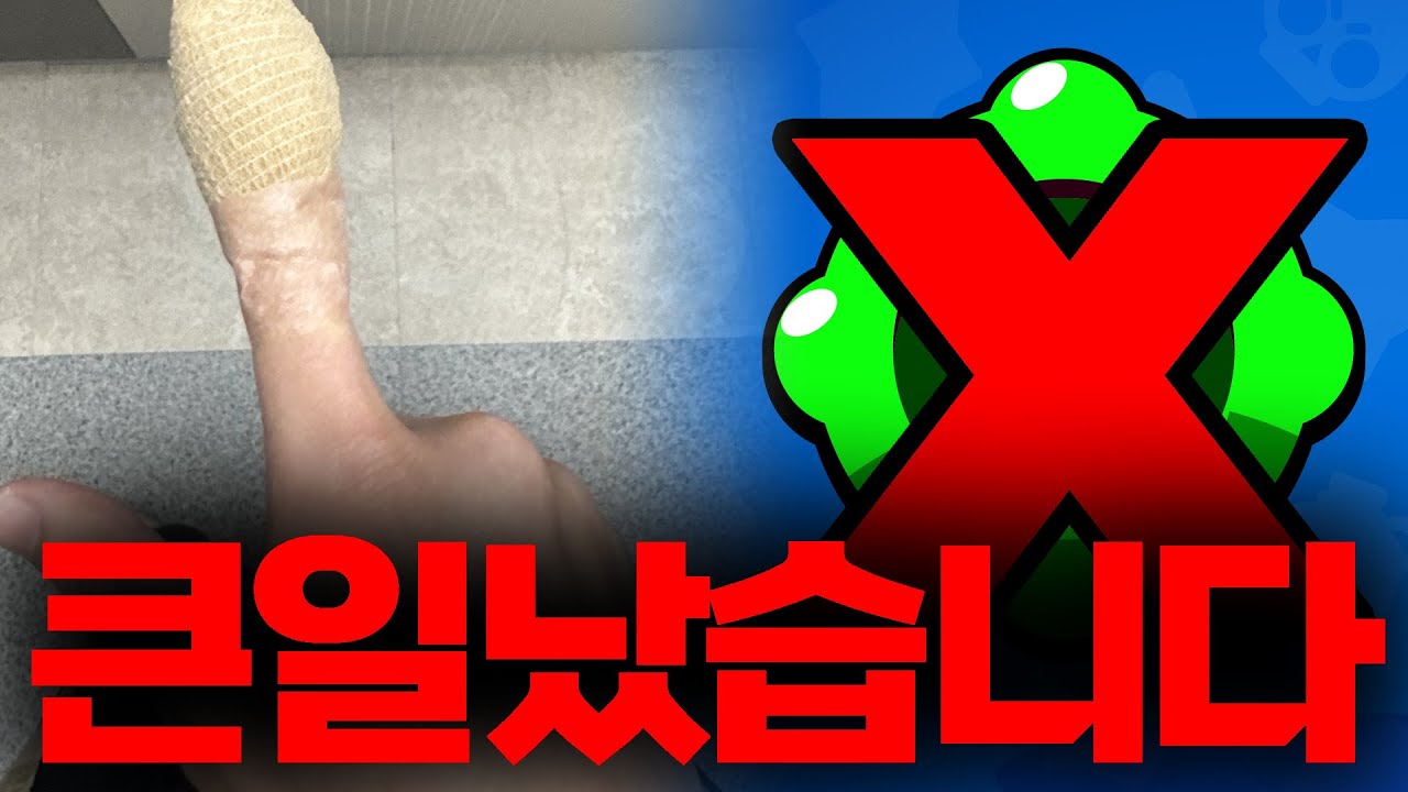 가젯을 이제 못 누른다고요…?