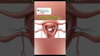 5 Weeks Pregnant – Baby with Anterior Placenta . #anteriorplacenta #pregnancy #baby #mothertobe