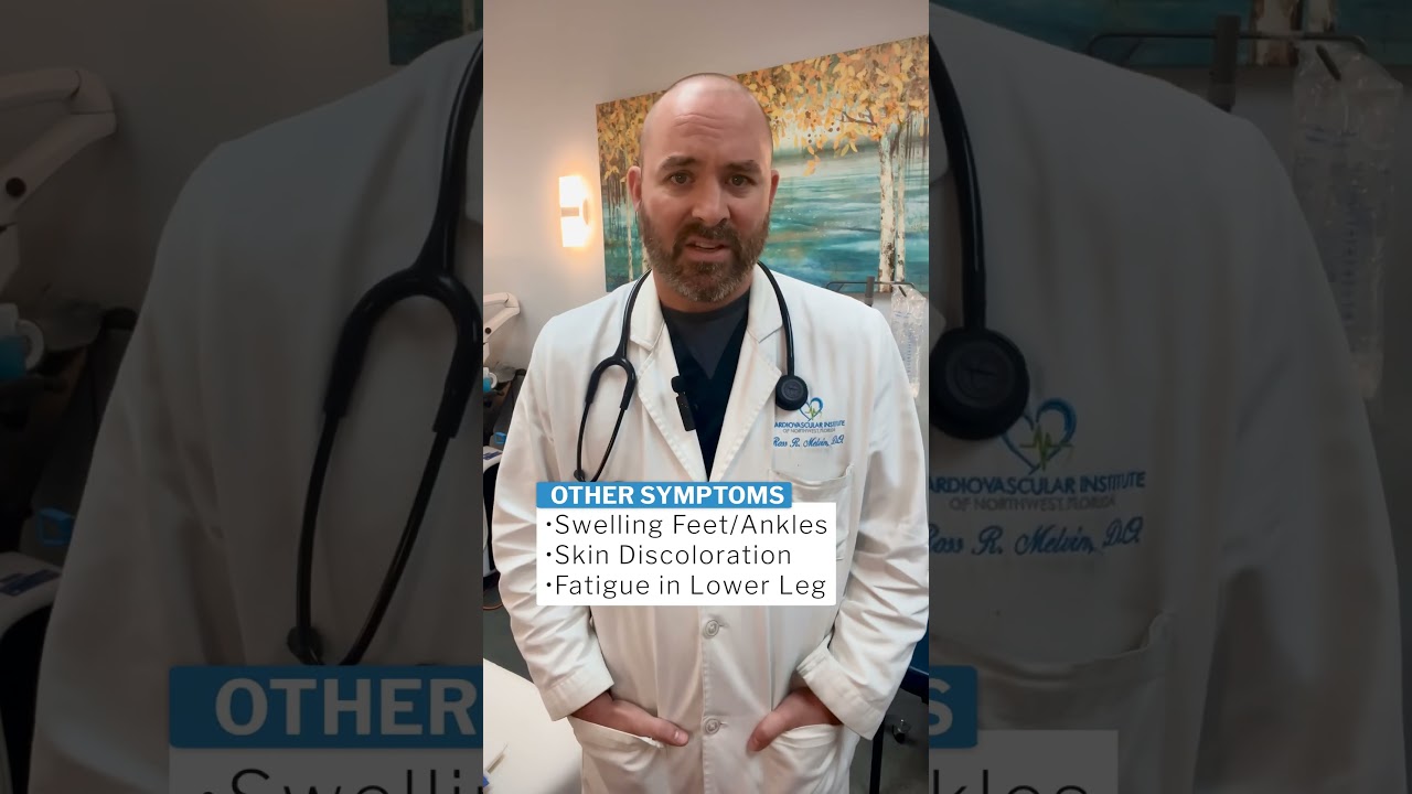 Varicose veins are not just a cosmetic problem 