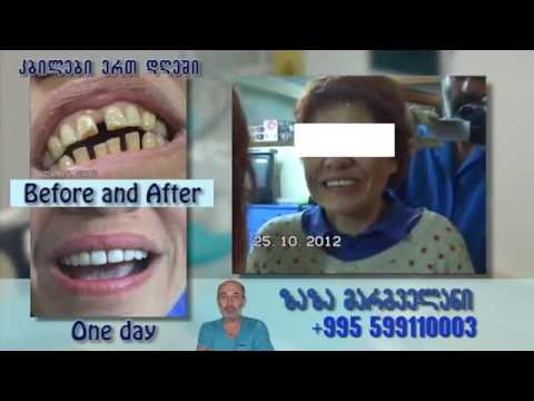 ZAZA MARGVELANI ზაზა მარგველანი stomatologiuri klinika