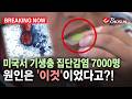 [브레이킹 나우] 미국서 기생충 집단감염 7000명...원인은 '이것'이었다고?!