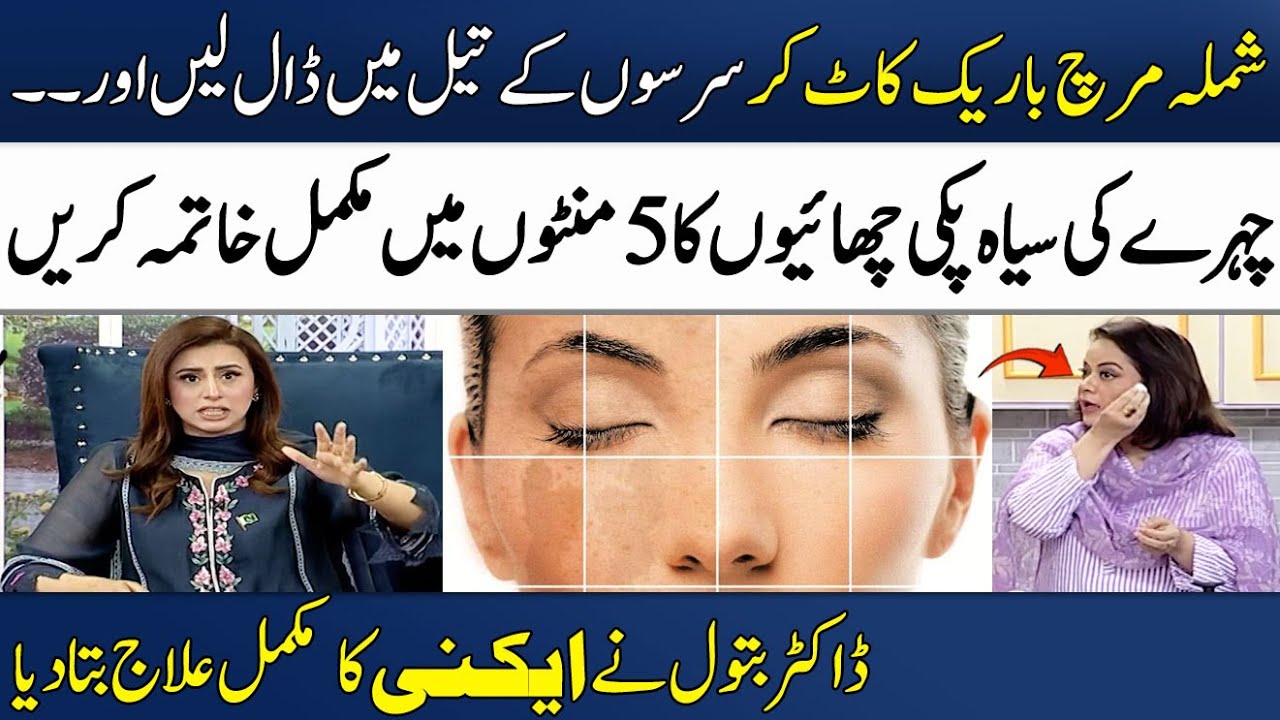 Chehre ki Chaiyon ka Ilaj (100%) | Treatment of Skin Wrinkles by Dr. Batool | Madeha Naqvi |SAMAA TV