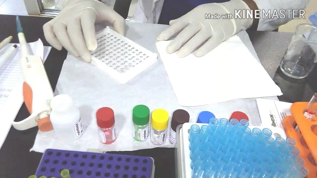 HBeAg Elisa preparation .