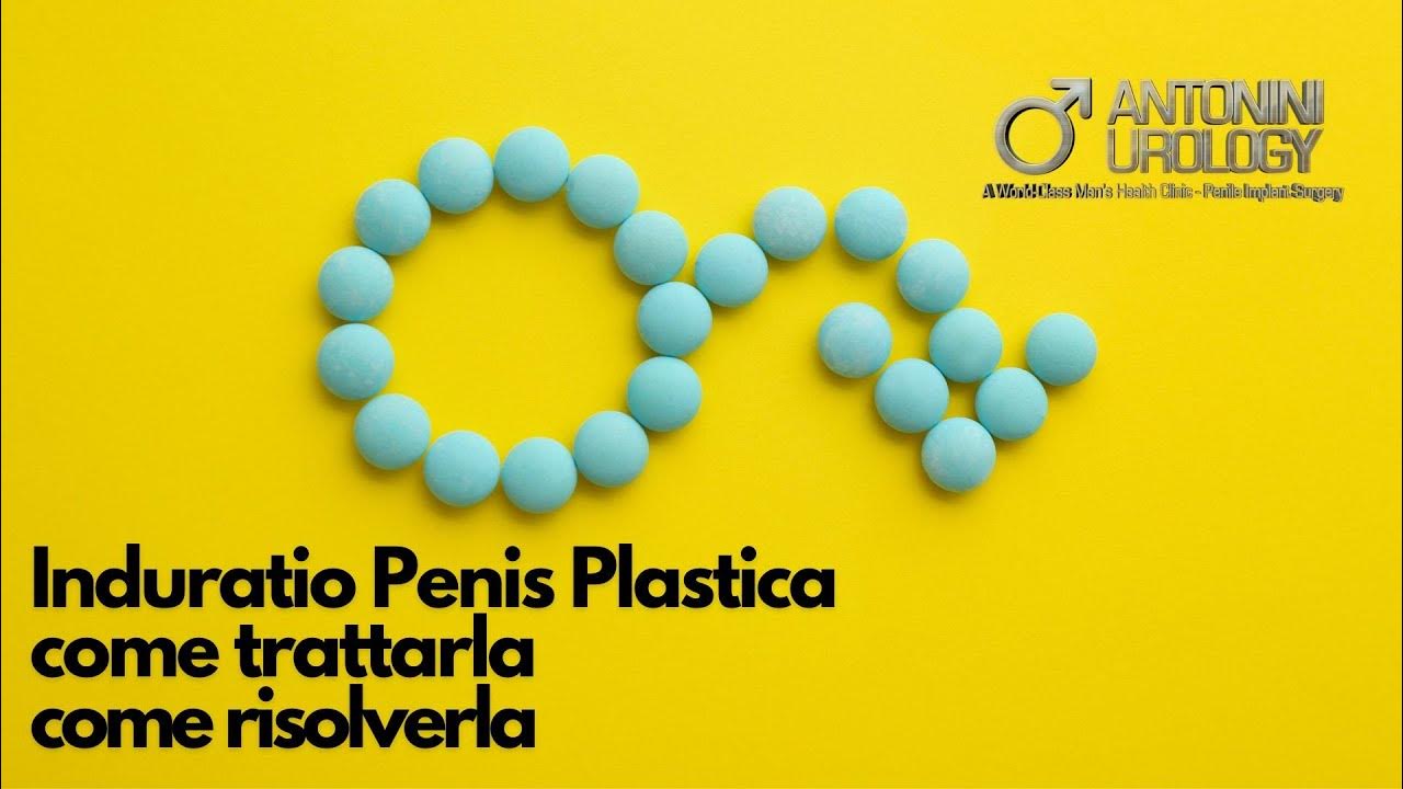 Induratio penis plastica malattia di La
