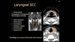 Imaging of larynx