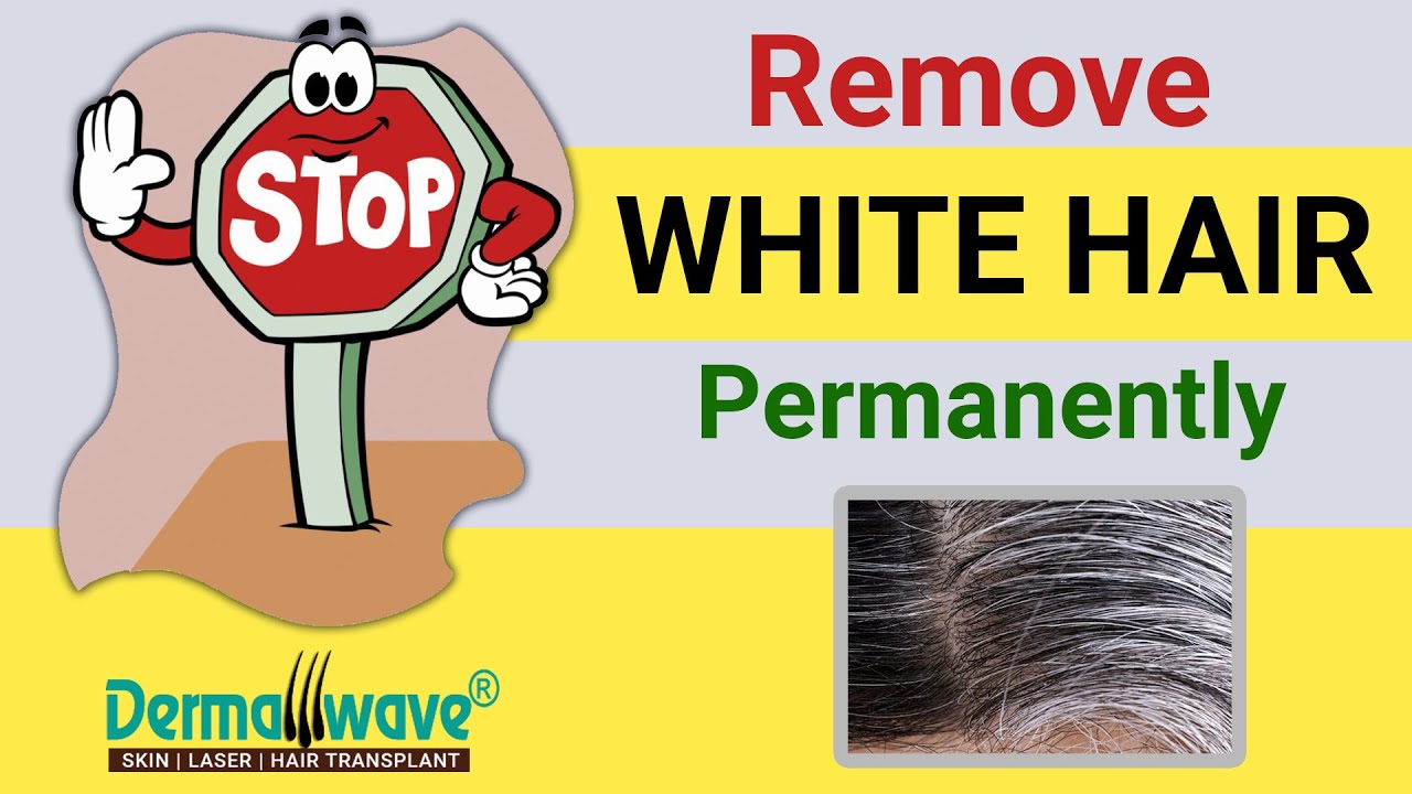 Remove White Hair Permanently White Hair Extraction by FUE