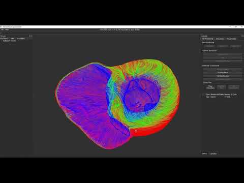 Personalized Cardiac Medical Twin Platform - Electrophysiology Simulation