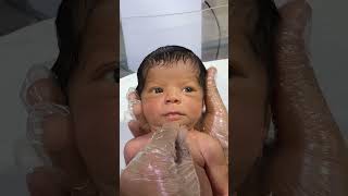 Cute Little Baby In Nicu With Nurse Love Under Phototherapy Care