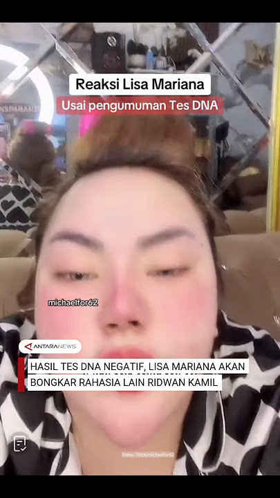 Lisa Mariana akan bongkar rahasia lain Ridwan Kamil usai hasil tes DNA dinyatakan negatif