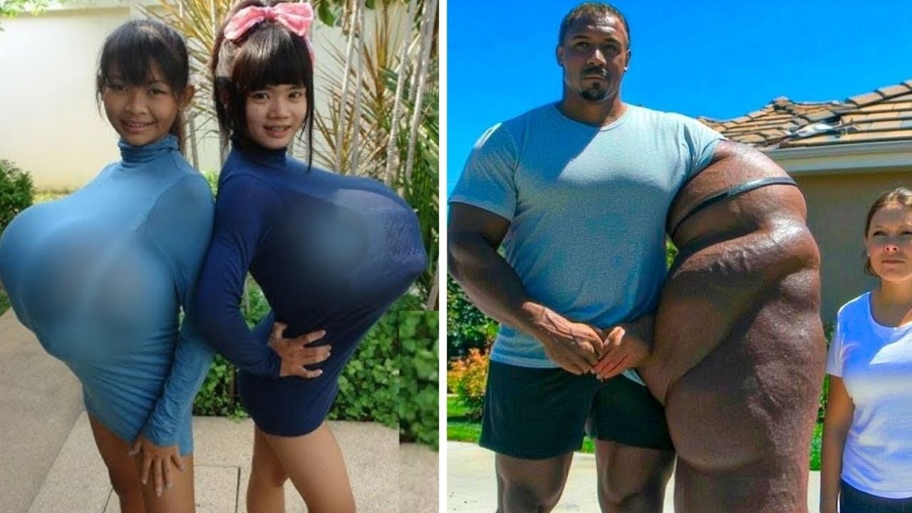 15 People with the Rarest BODY Features in the World - YouTube