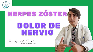 ¿Qué ayuda al dolor de herpes zóster en la cabeza?