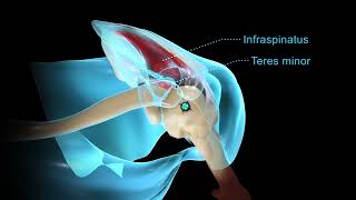 Biomechanical Summary of Equinoxe Reverse Shoulder Arthroplasty