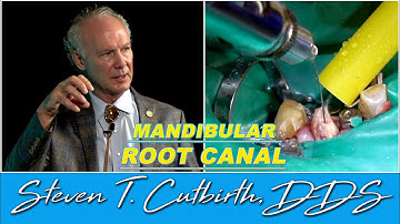Mandibular Cuspid Root Canal - Dental Minute with Steven T. Cutbirth, DDS
