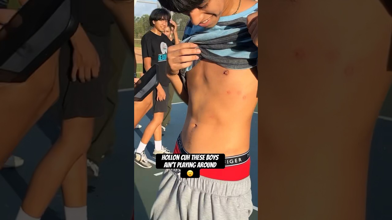 😮 THEY SHOT HIM A 100 TIMES WITH A SPLATRBALL GUN 😱 I KNOW THAT HURTED🤕