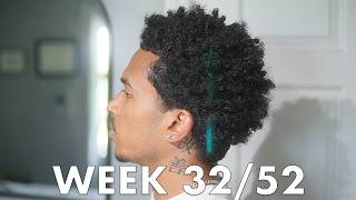 1 Year Hair Growth Journey: My Scalp Is So Itchy (Week 32/52)