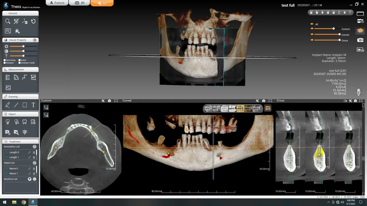 3D PLANLAMA TƏLİMİ / İlk dəfə Azərbaycan dilində / Odontos