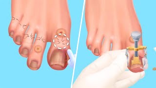 Hotel Craze | 👩🏻‍⚕️Pembersihan Kaki 🦶💅🏻| Mini Games Part 3 screenshot 4