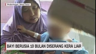 Download lagu Teror Penyerangan Kera, Bayi 10 Bulan Terluka