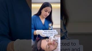 Face PRP with Microneedling | Collagen Boosting Treatment #udaipur #faceprp #vampirefacial