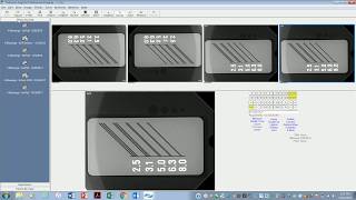 Sopix2 in Eaglesoft