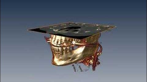 3D visualization of a head CT scan