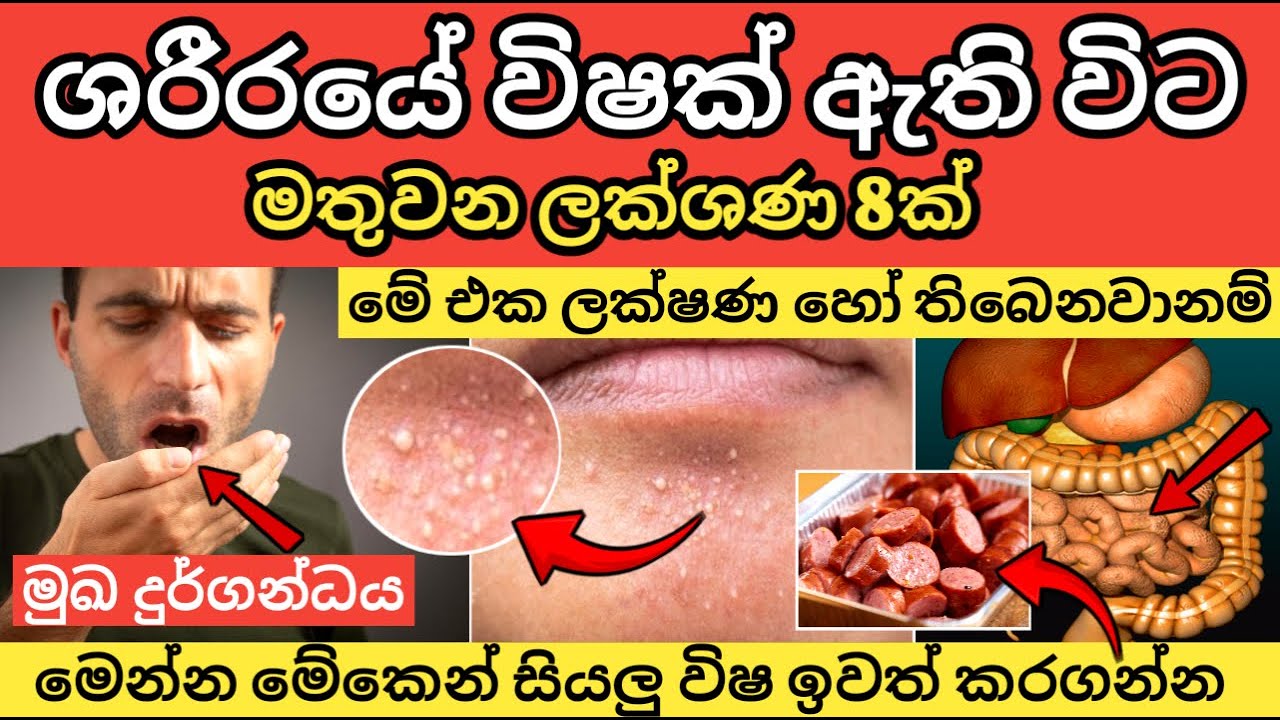 ශරීරයේ විෂ තැන්පත්ව ඇතිවිට මතුවන ලක්ෂණ 8ක්. 8 Signs Your Body Has Too Many Toxins.