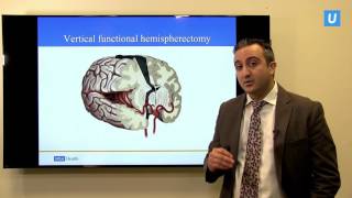 Hemispherectomy: When half the brain is better than the whole | Aria Fallah, MD | UCLAMDChat