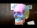 Hololens skull demo
