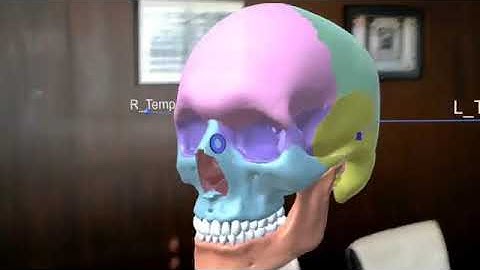HoloLens Skull Demo