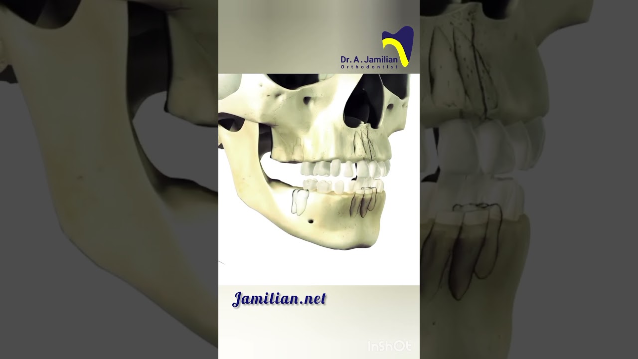 Sequence eruption of Primary and Permanent Dentition  