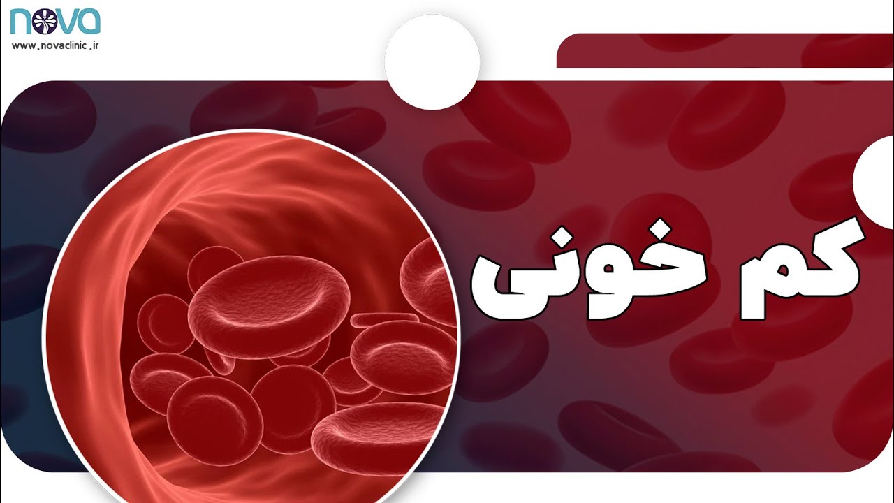 علائم کم خونی (آنمی) چیه ؟ و برای کم خونی چی کار کنیم؟